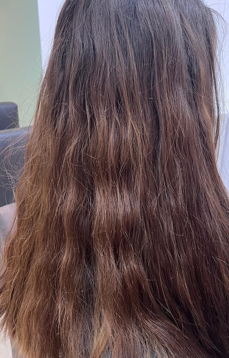 Antes