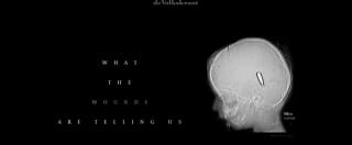 European Press Prize 2026. Reporting Award 2026 Winner "What the wounds are telling us". Premio Europeo de Prensa 2026. Ganador del Premio a la Excelencia Periodística 2026  «Lo que nos dicen las heridas» ENG ESP