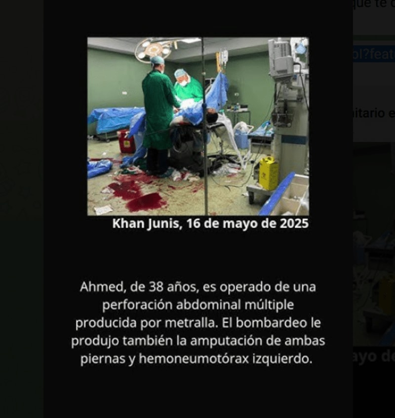 Hospital Nasser. Gaza Mayo 2025 Heridas de guerra Imágenes y relatos ciertos, vívidos y duros