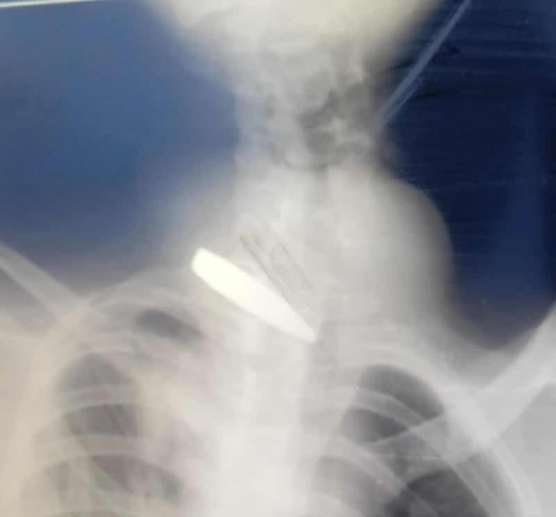 Öppet brev till Elisabet Lann