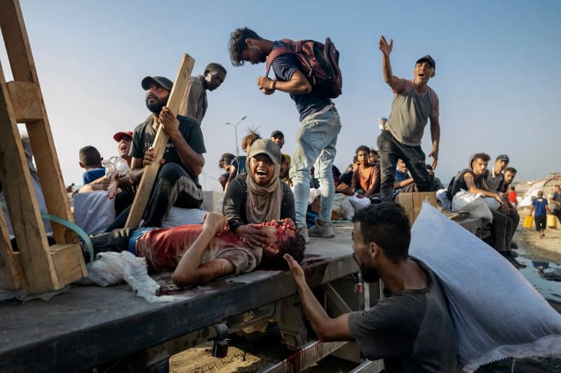 The 2026 Pulitzer Prize Winner in Breaking News Photography. Saher Alghorra. Las fotografías de Saher Alghorra de Gaza, ganaron el Pulitzer. ENG ESP