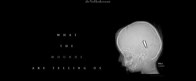 European Press Prize 2026. Reporting Award 2026 Winner "What the wounds are telling us". Premio Europeo de Prensa 2026. Ganador del Premio a la Excelencia Periodística 2026  «Lo que nos dicen las heridas» ENG ESP