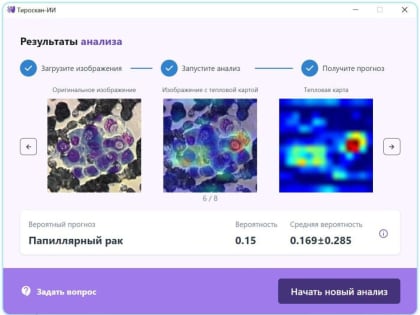 Донецкие медики разработали технологию диагностики заболеваний щитовидной железы