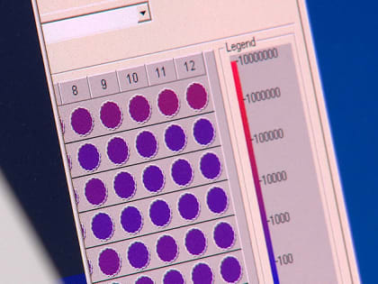 Новорождённых Алтайского края теперь обследуют на 36 генетических заболеваний