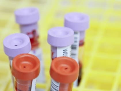 Жителей Заринска приглашают пройти бесплатное тестирование на ВИЧ