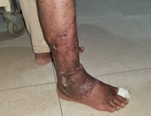 Trauma Surgery - After