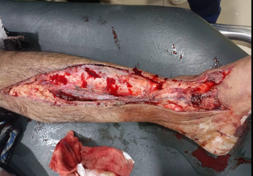 Trauma Surgery - Before