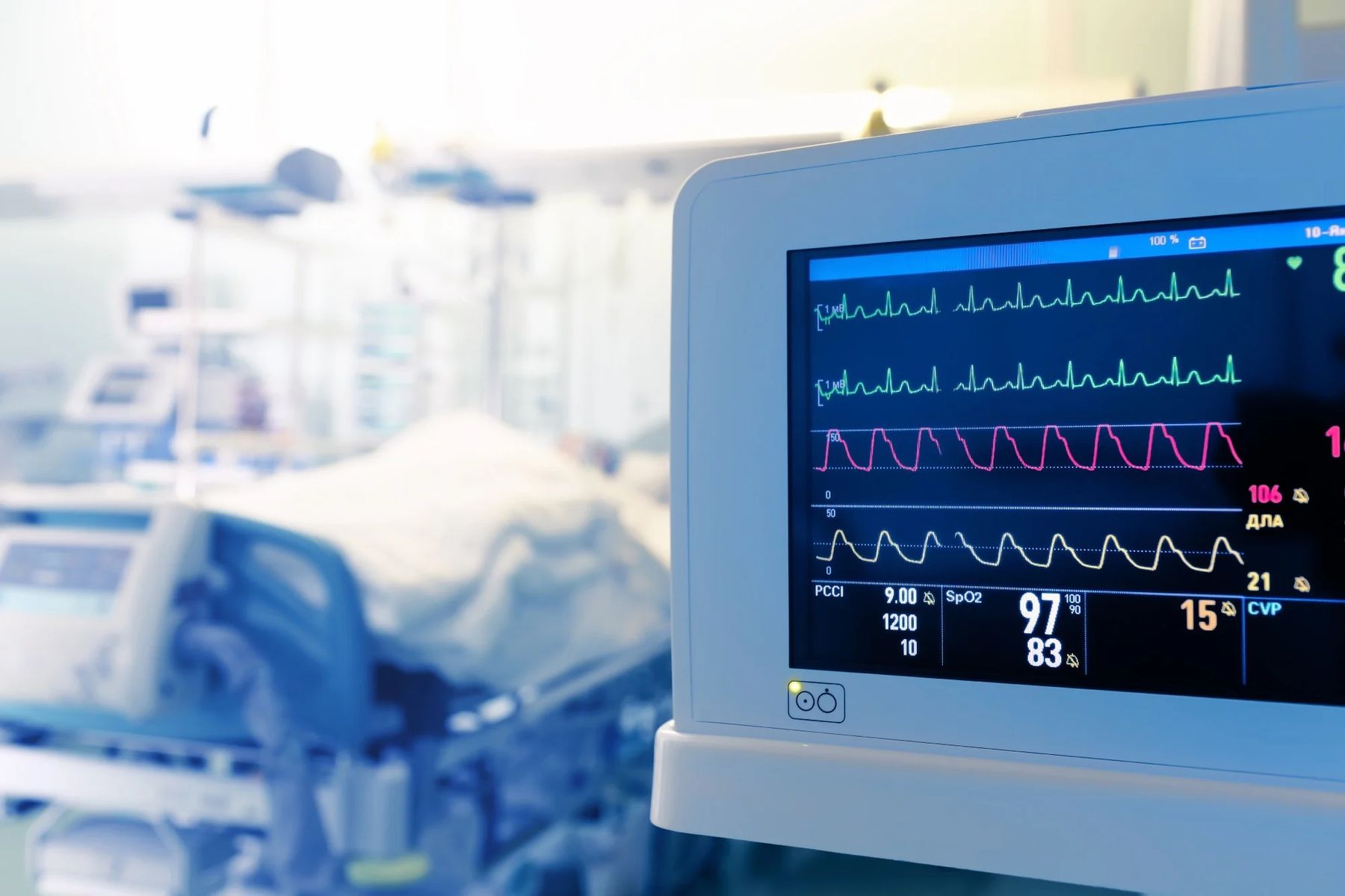 Bedside patient monitor displaying vital signs in an intensive care unit