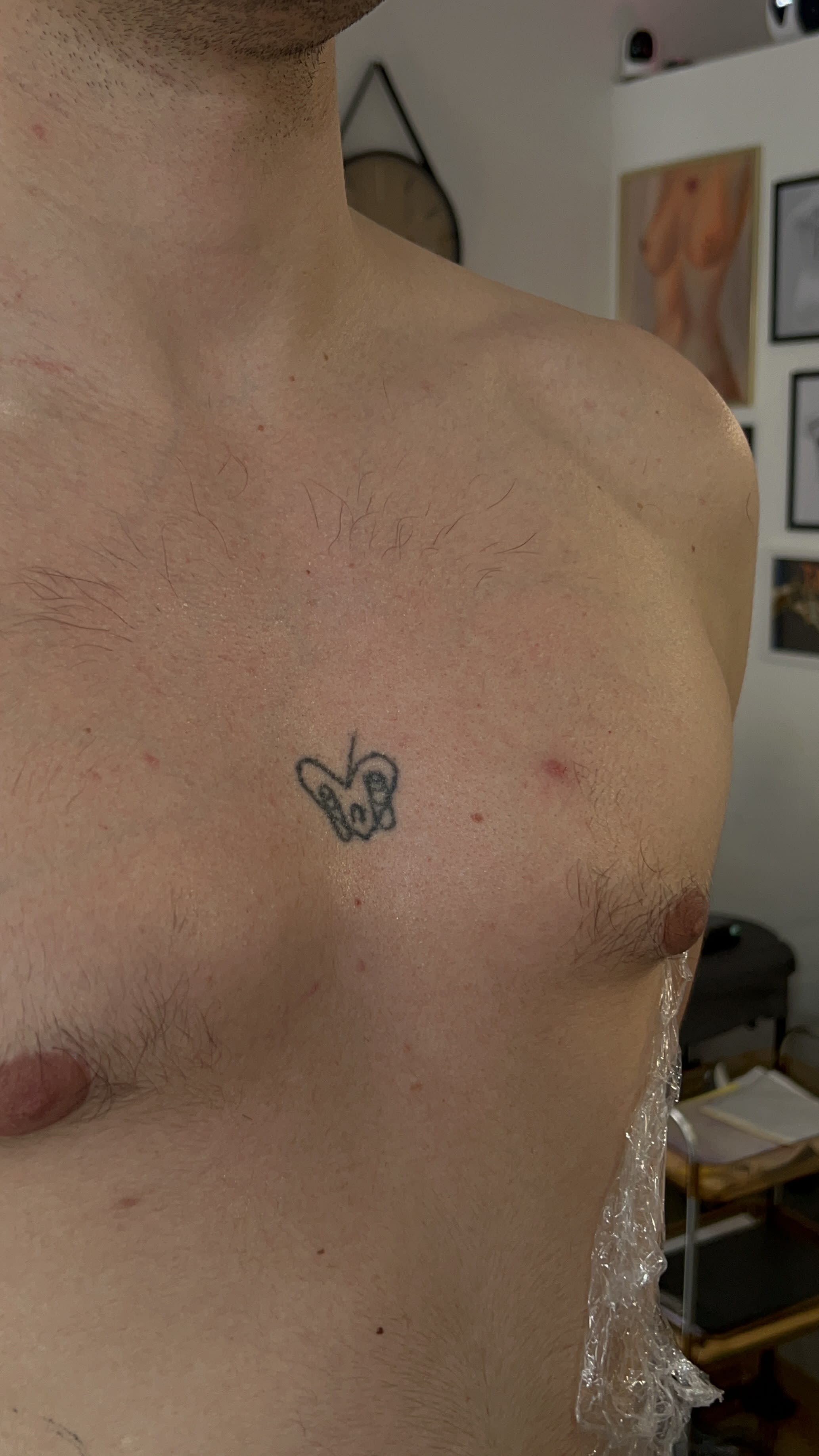 Metamorfoza tatuażu na klatce piersiowej: mały, rozmyty symbol zastąpiony czarnym sercem przebitym trzema mieczami. — Przed