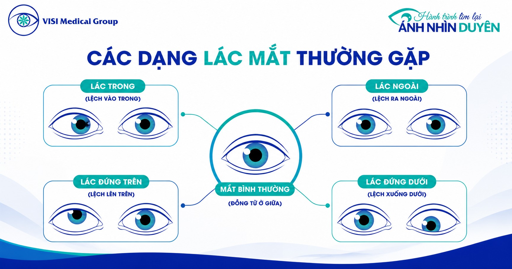 Các hình thái lác mắt thường gặp bao gồm lác trong, lác ngoài và lác đứng dọc
