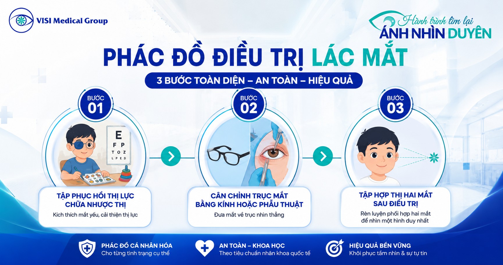 Sơ đồ phác đồ 3 bước điều trị lác mắt chuyên sâu chuẩn y khoa tại VISI