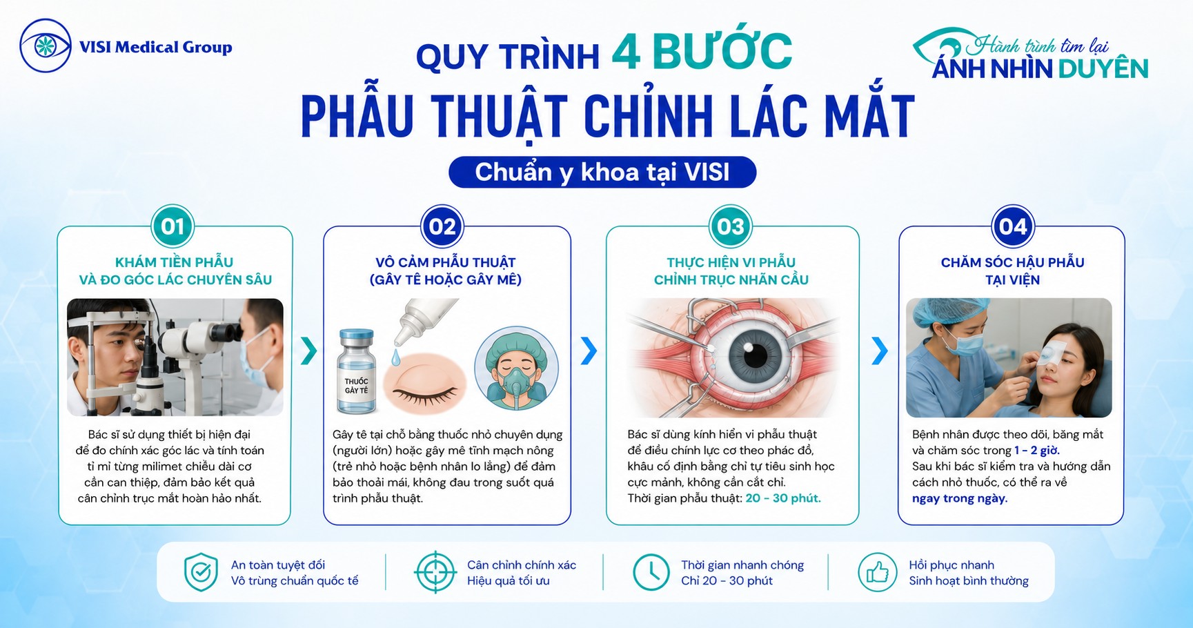 Quy trình phẫu thuật mổ lác mắt 4 bước chuẩn y khoa tại VISI