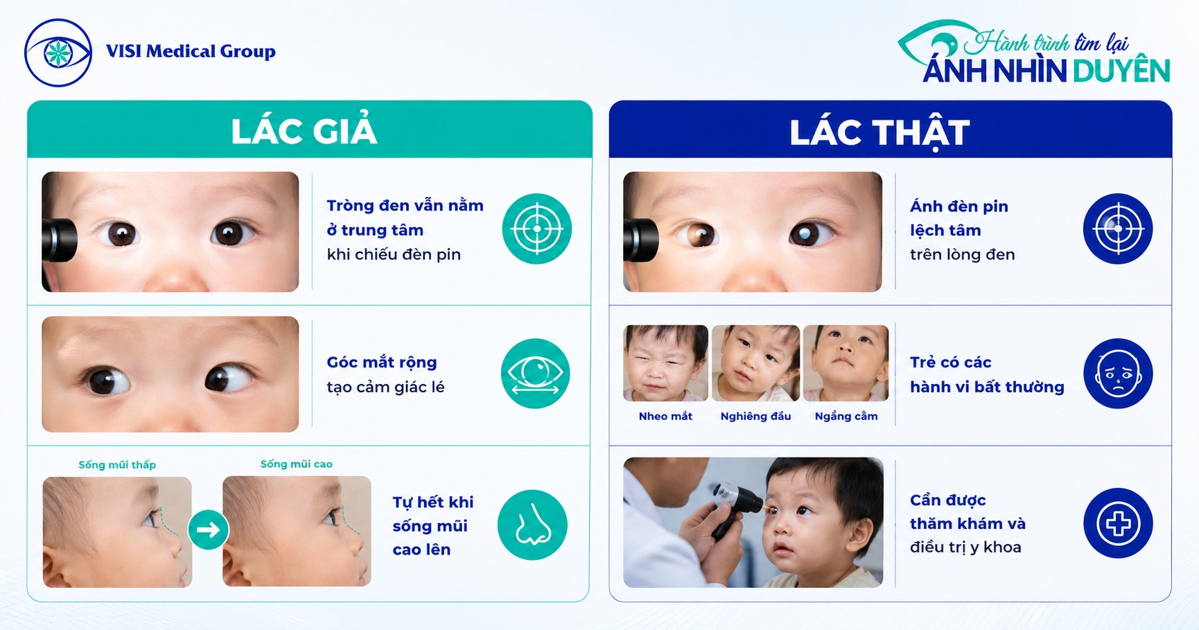 Bảng phân biệt hiện tượng lác thật và lác giả thường gặp ở trẻ nhỏ