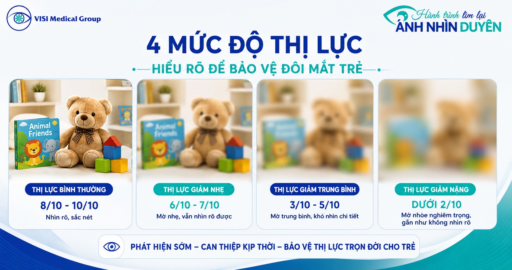 Mô phỏng các mức độ suy giảm thị lực nhược thị từ nhẹ đến nặng ở trẻ em