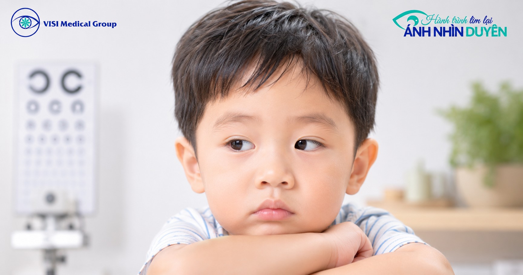 Hiện tượng một bên mắt của trẻ bị lệch hướng gián đoạn khi cơ thể mệt mỏi