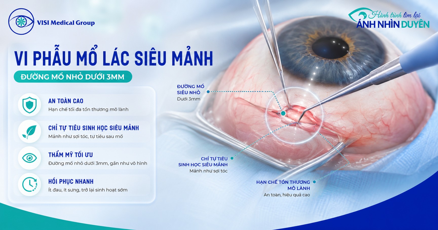 Công nghệ vi phẫu chỉnh trục cơ vận nhãn không để lại sẹo tại VISI