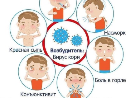 Осторожно:корь!