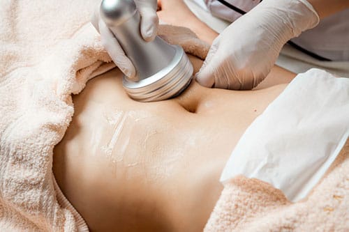 Radiofrequência e lipocavitação em tratamento corporal