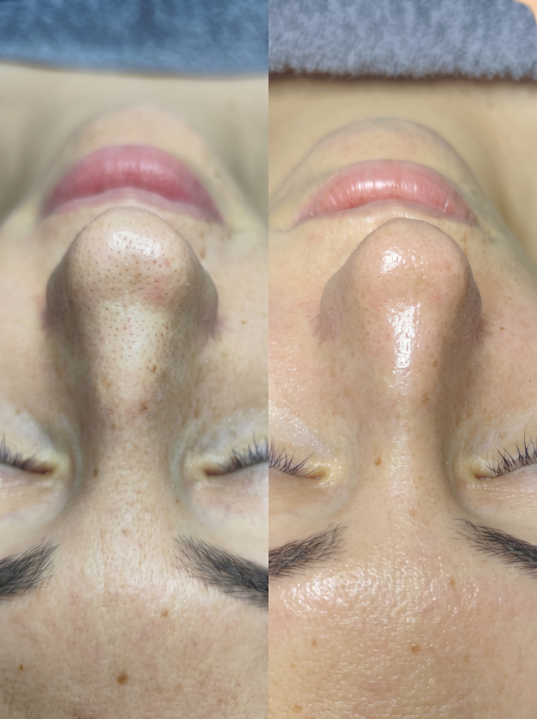 Tratamento corporal e estética na Sublime, Largo do Corpo Santo, Setúbal