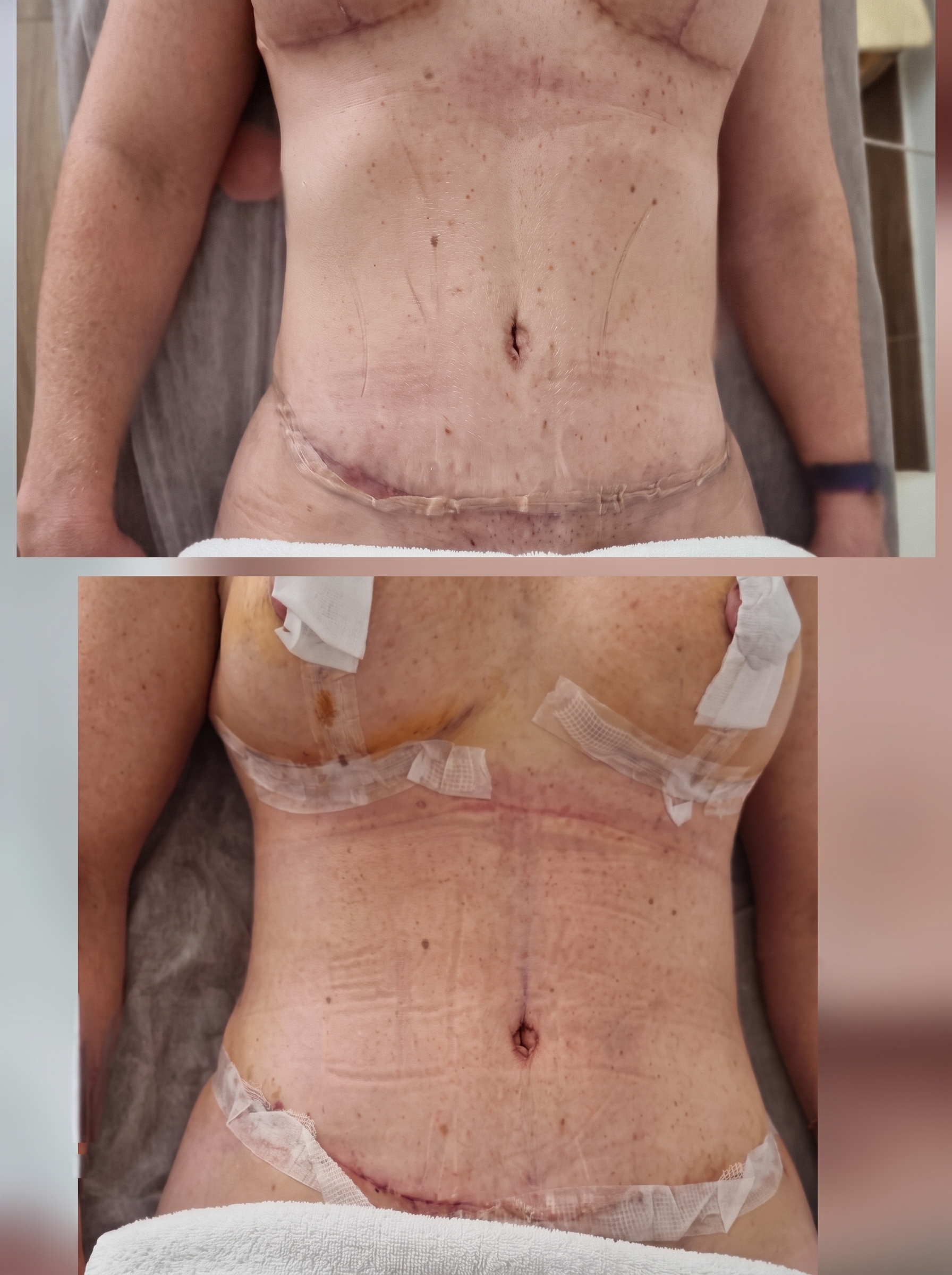 Tratamento de estética avançada no Estúdio Márcia Veiga em Santarém, Portugal