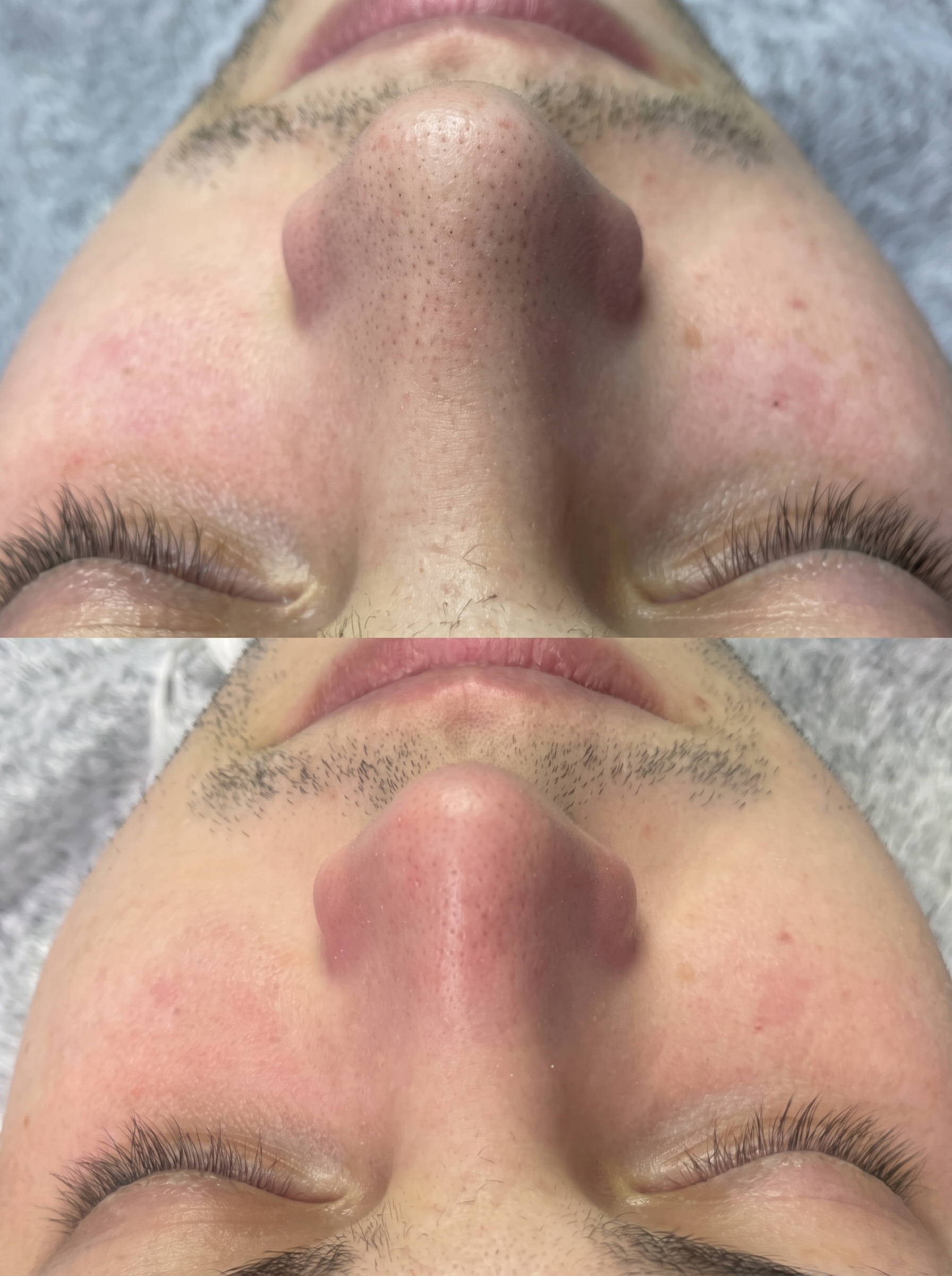 Tratamentos faciais personalizados e cuidado estético avançado na Victory Clinic Trofa