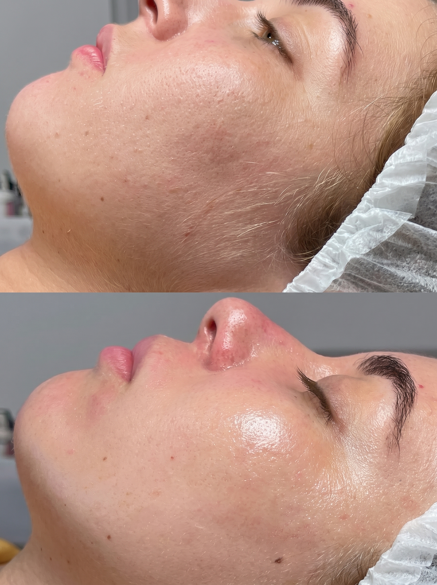Cavitação e pressoterapia na Victory Clinic, clínica de estética avançada em Trofa