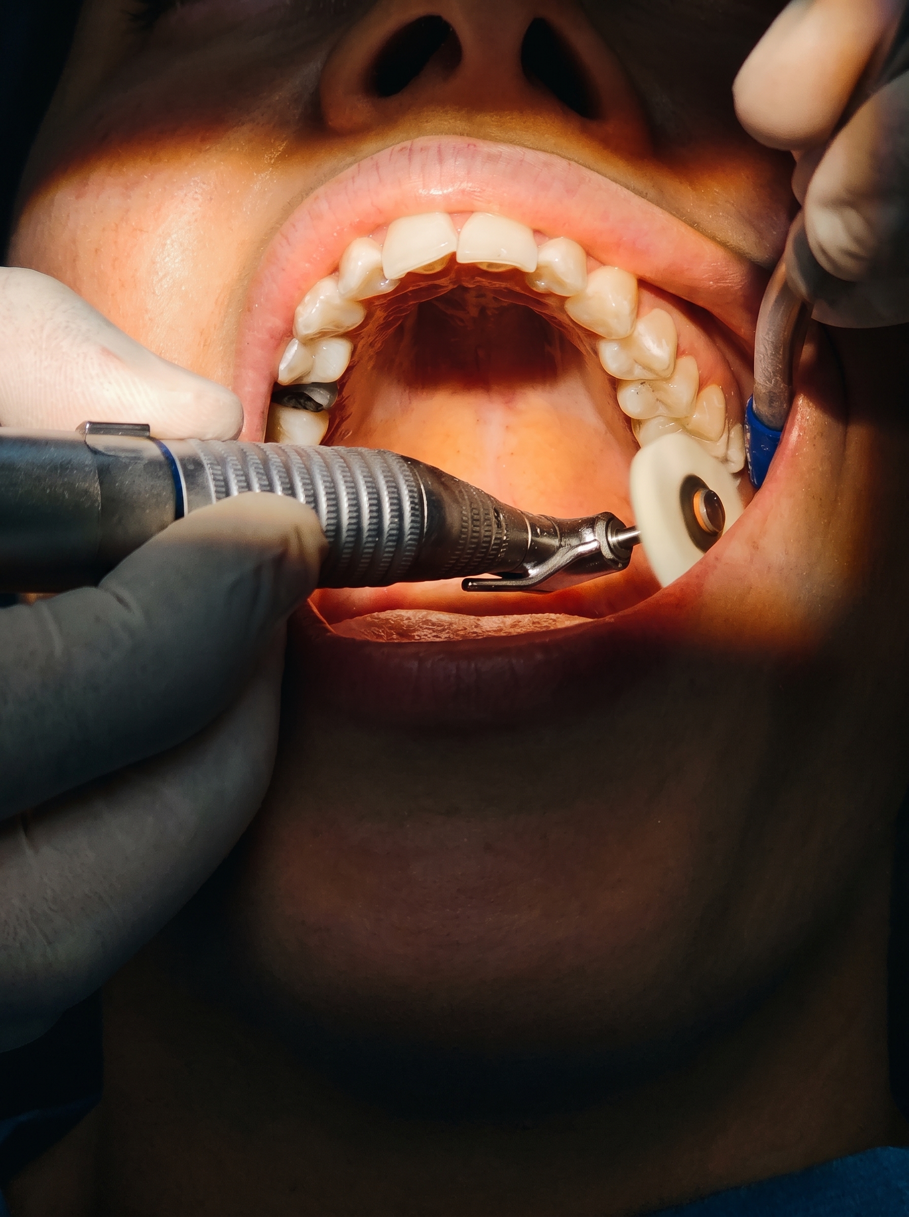 Consulta de avaliação e tratamentos dentários no Instituto Face e Vida Porto