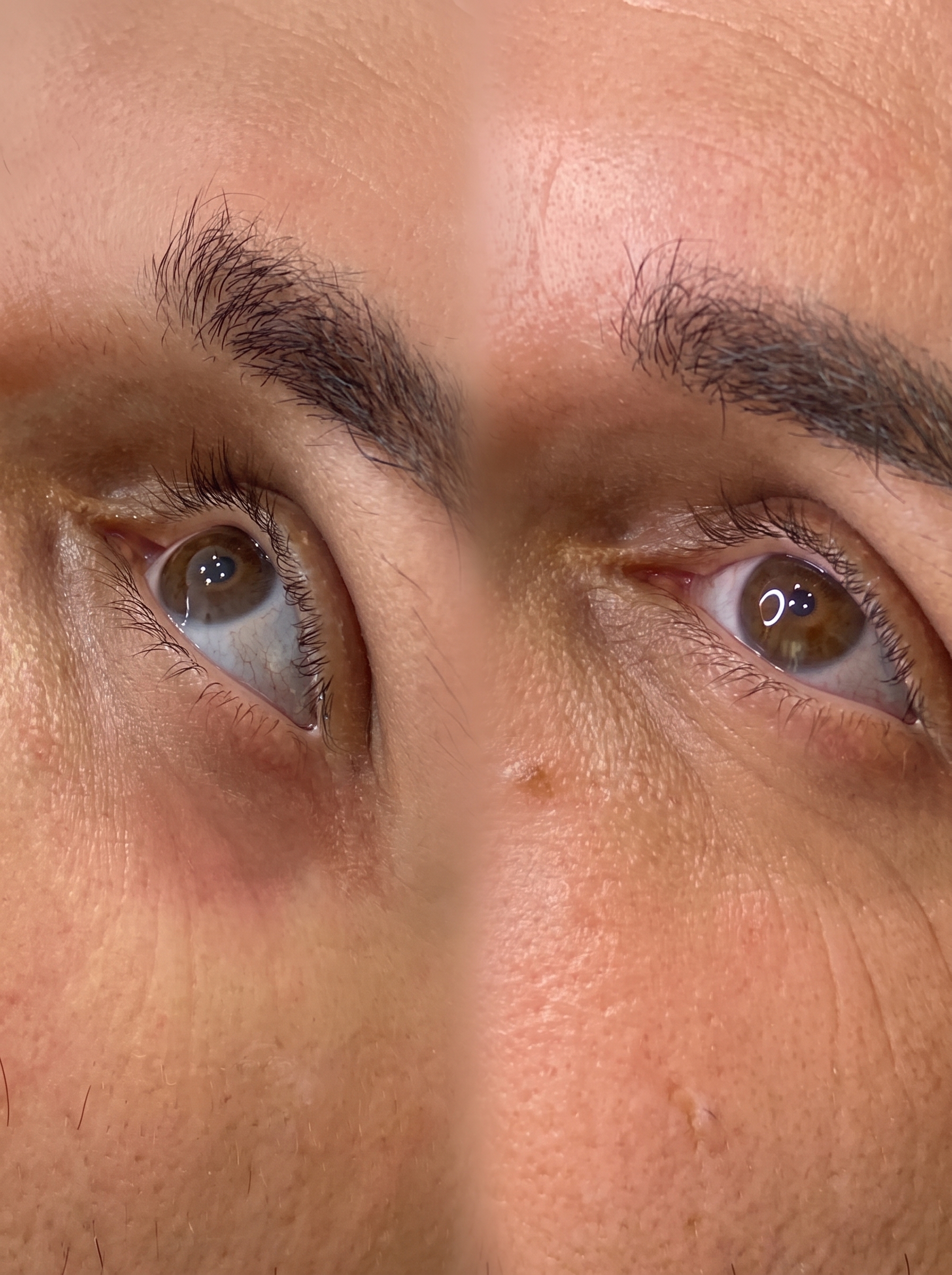 Pellem Aesthetics Quarteira, clínica especializada em harmonização facial com avaliação 5,0 no Google