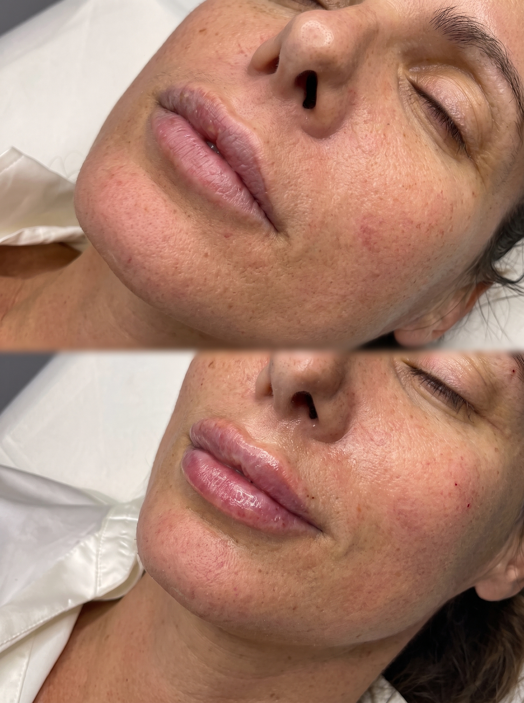 Medicina estética injetável na Pellem Aesthetics, Quarteira
