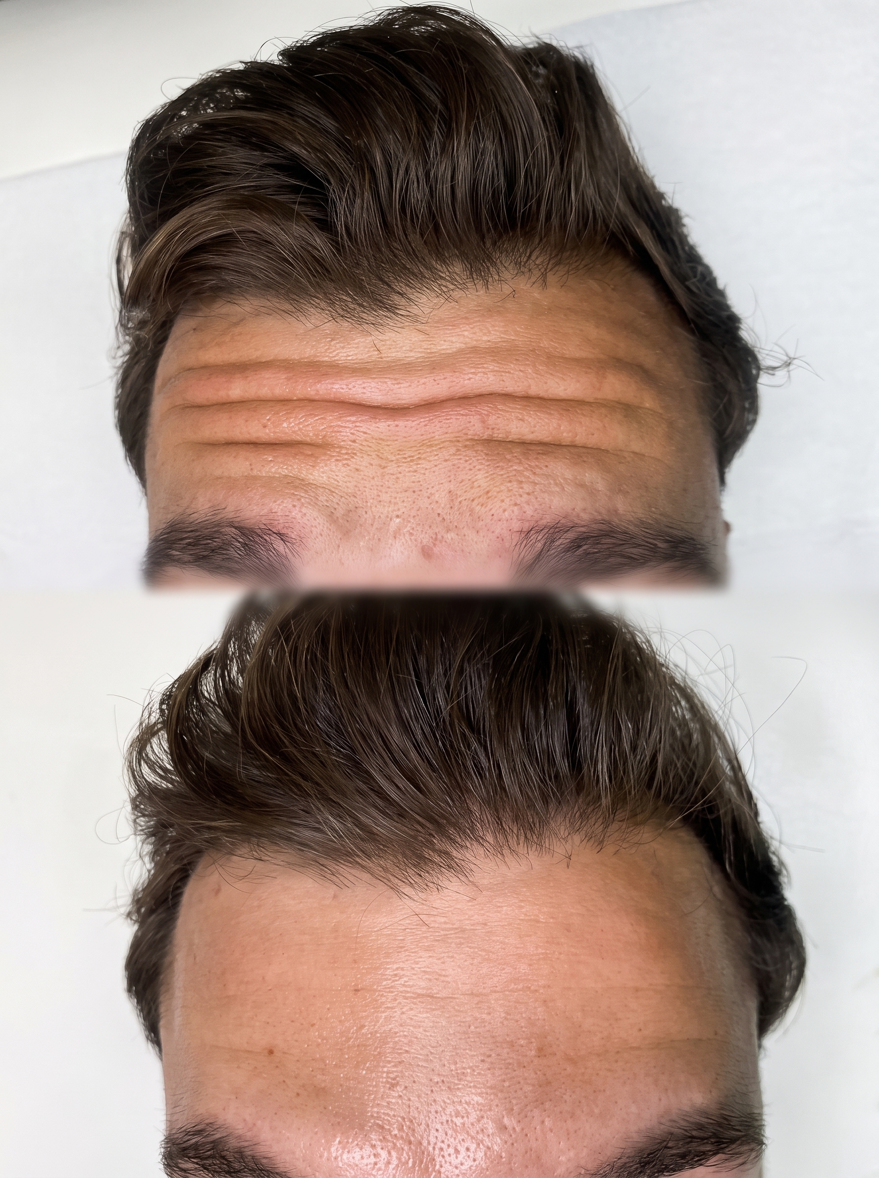 Harmonização facial na Pellem Aesthetics em Quarteira, Algarve, Portugal
