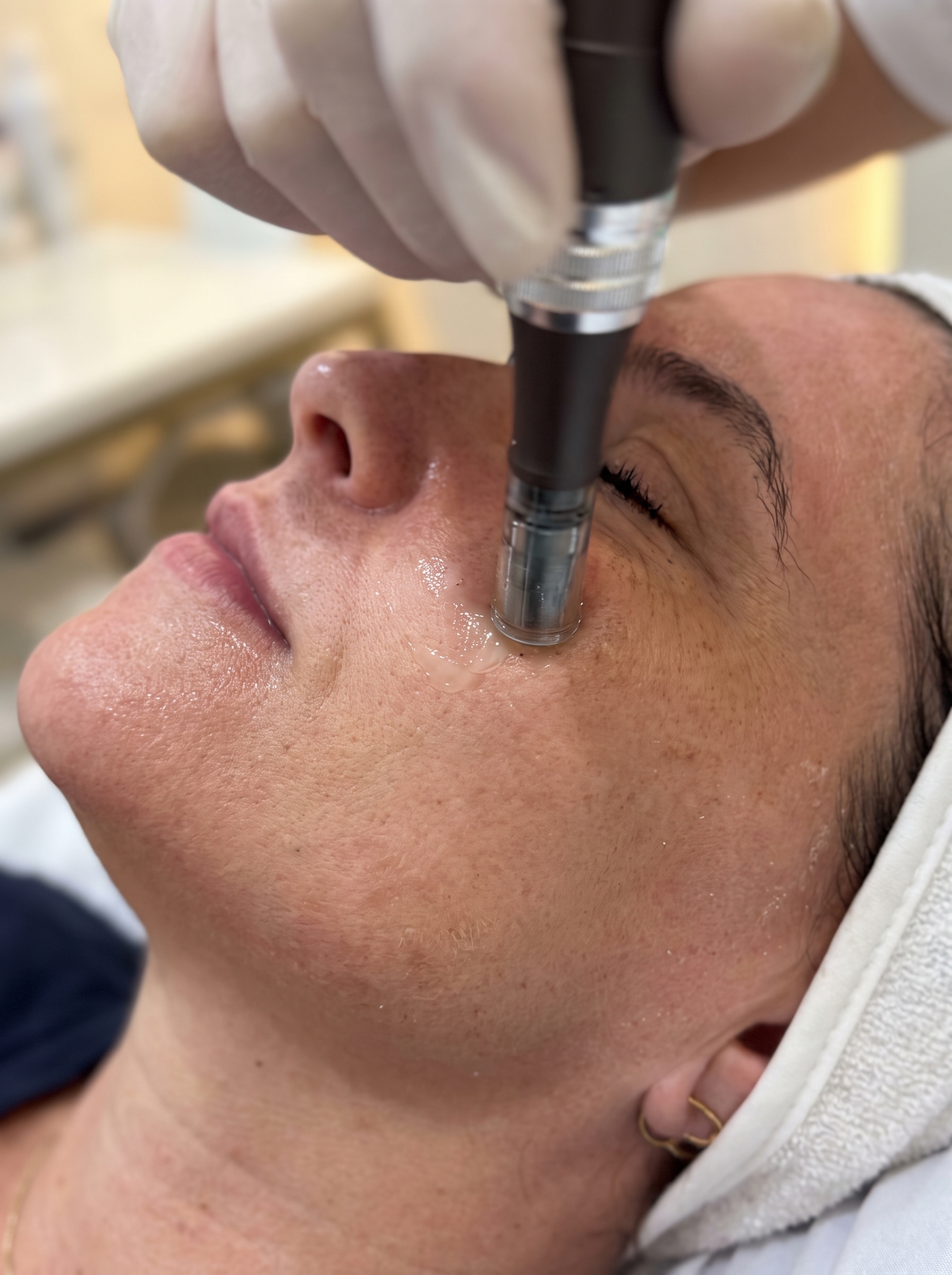 Glow Facial e limpeza de pele no Espaço Vênus, Malveira