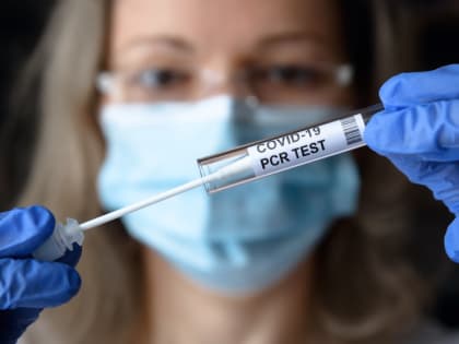 В Марий Эл зарегистрировано 17 случаев ковид за сутки