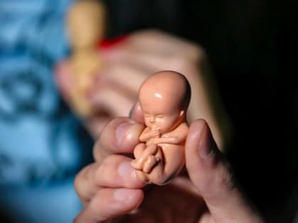 Четвертый год подряд основной причиной смерти в мире стали аборты