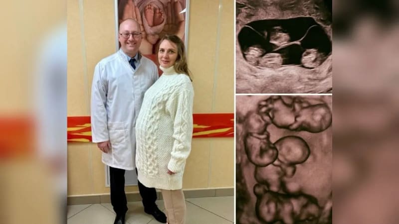 Medical Marvel in St. Petersburg: Russian Mother Defies 1-in-15 Million Odds with Identical Quadruplets