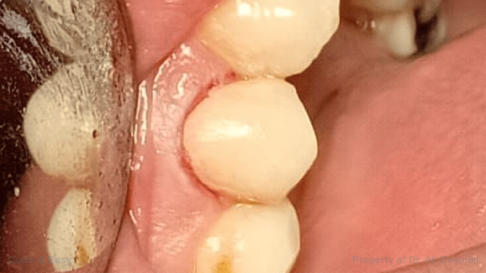 Case Picture