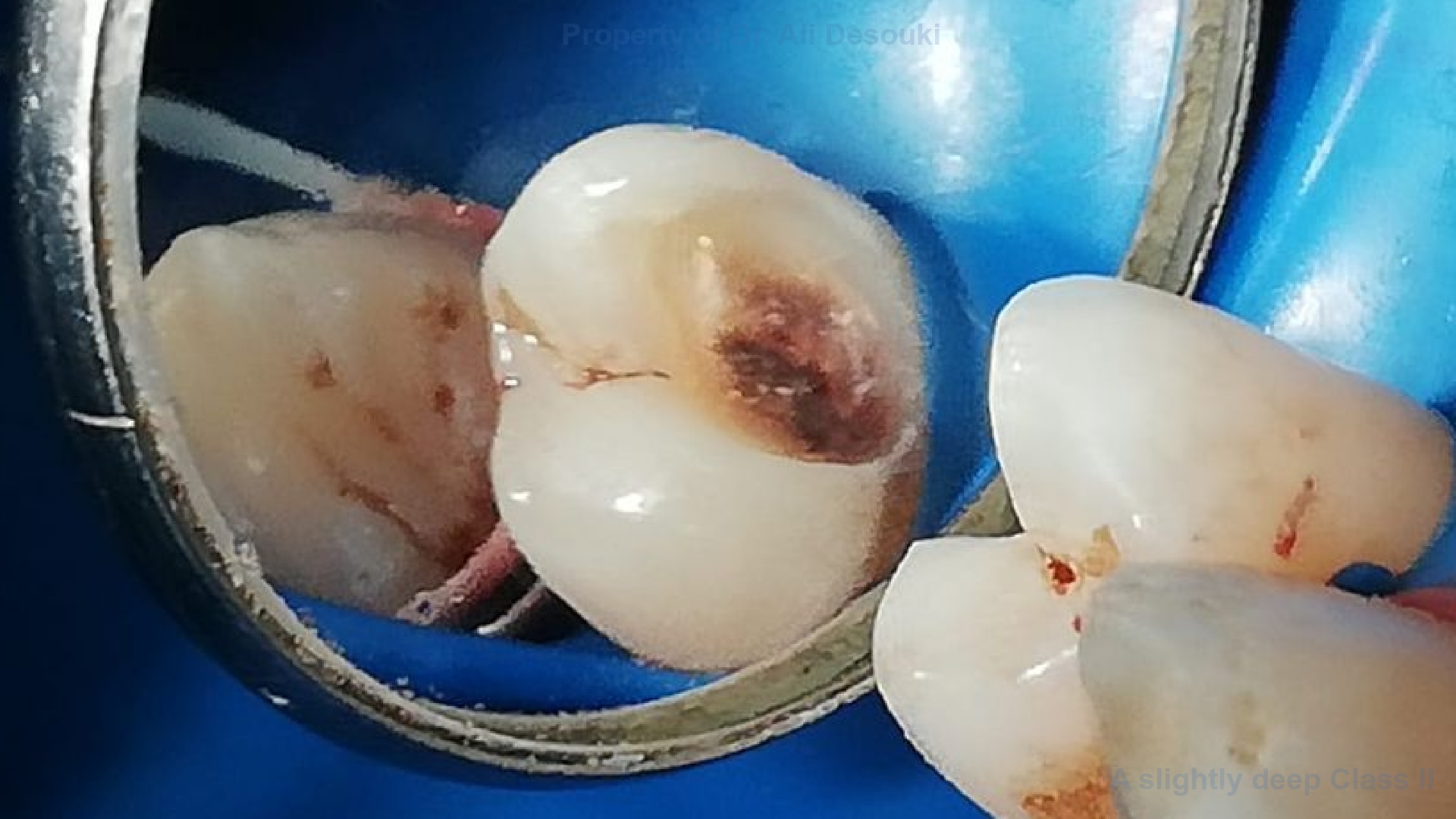 Case Picture