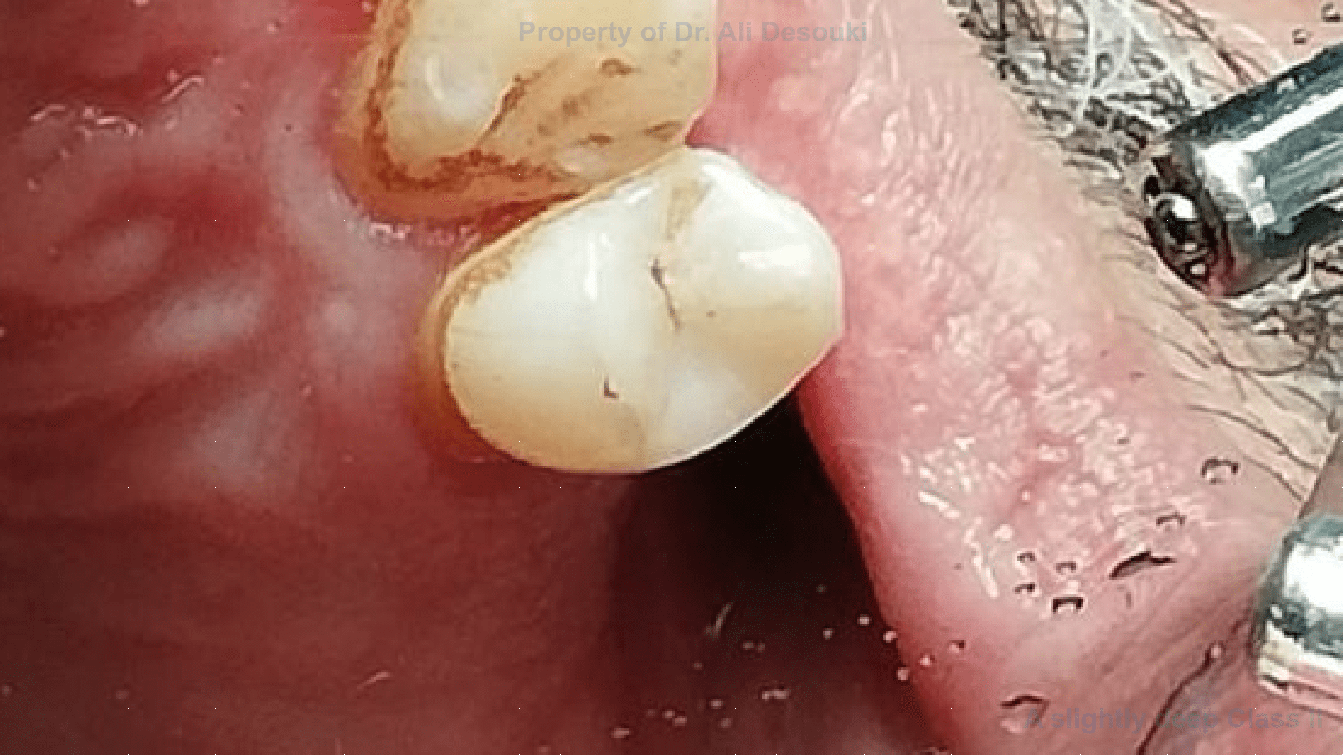Case Picture