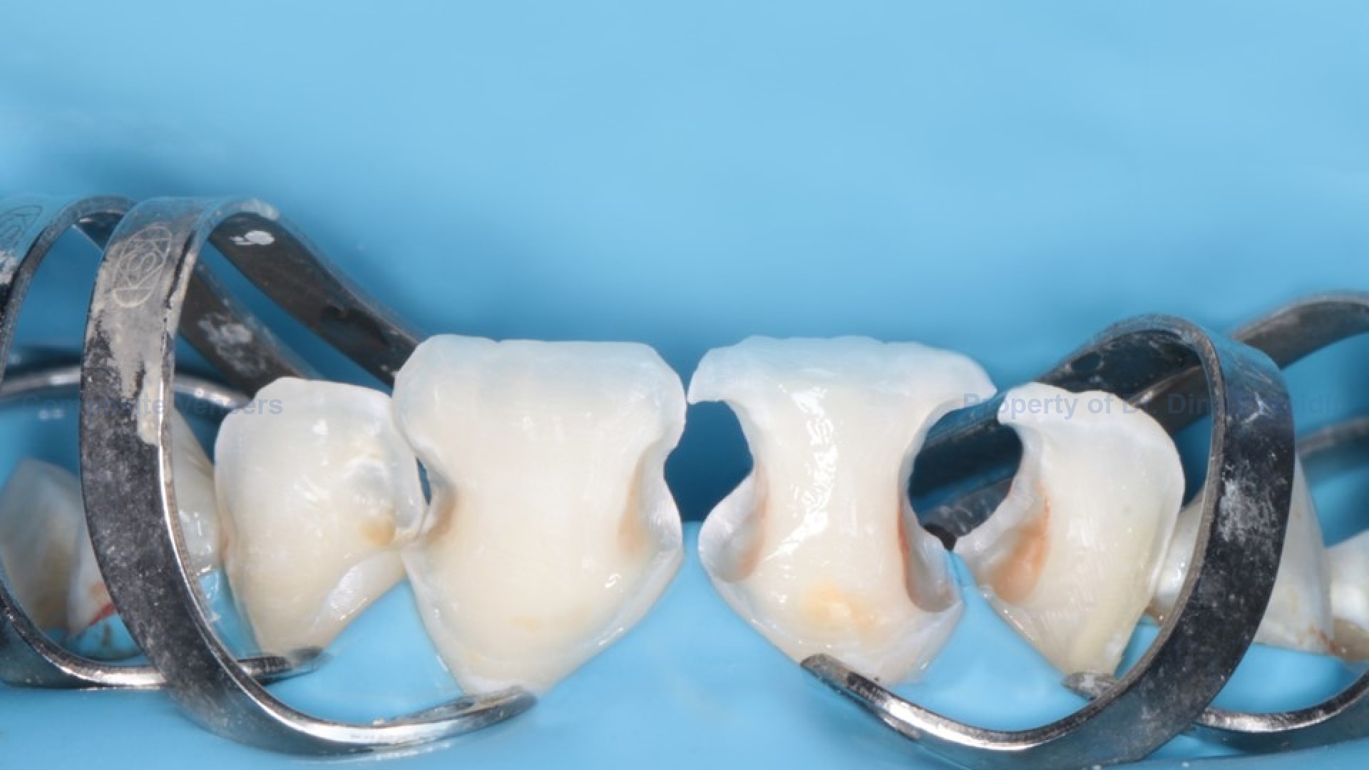 Case Picture