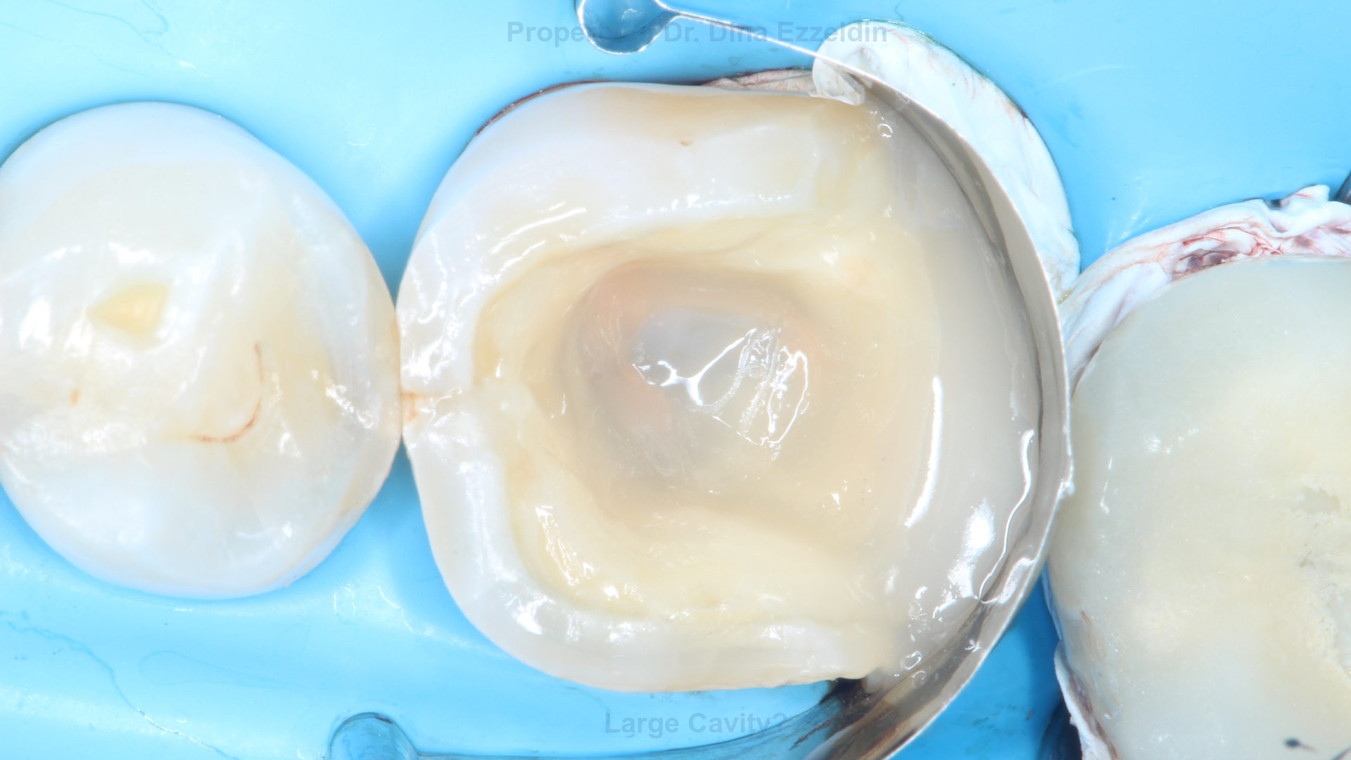 Case Picture