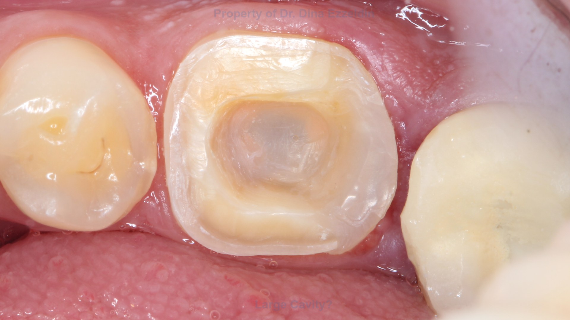 Case Picture
