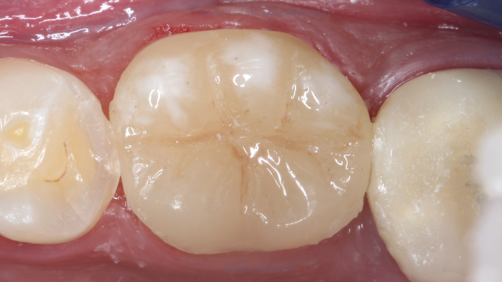 Case Picture