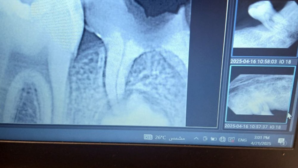 Cute Girl want to Smile Again Picture