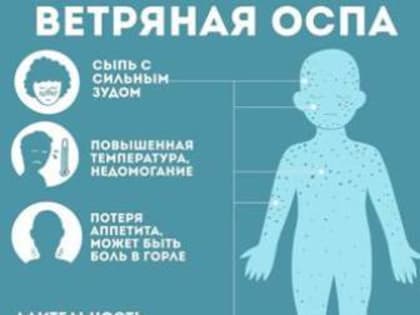 Правила профилактики ветряной оспы