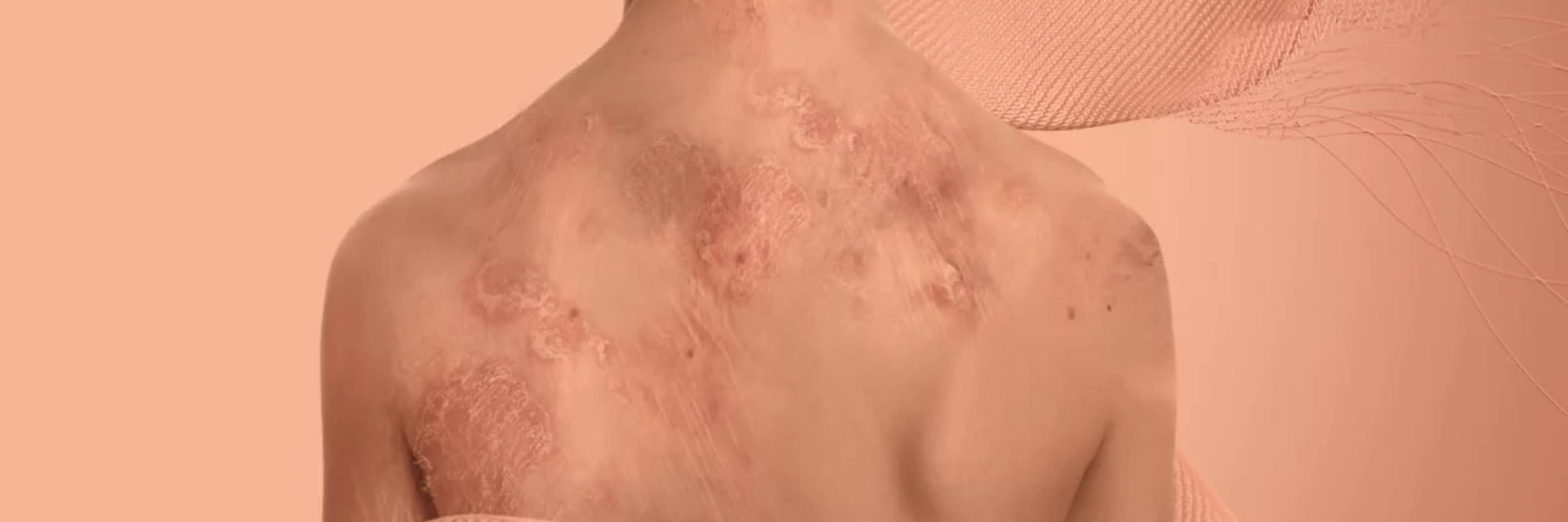 Copper Skin