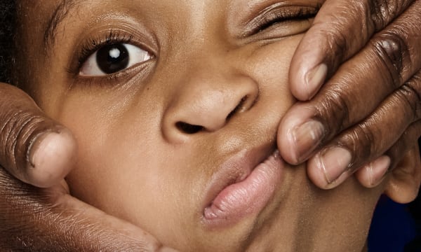 A young boy gets vaseline rubbed into his face by an older relative