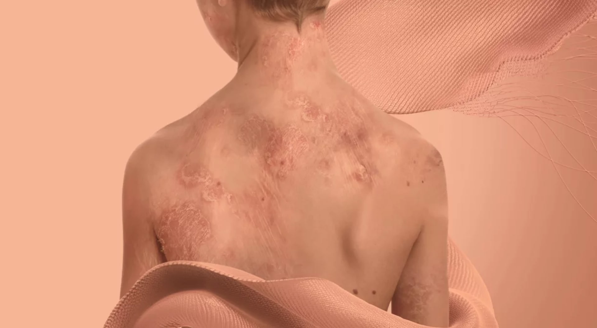 Copper Skin
