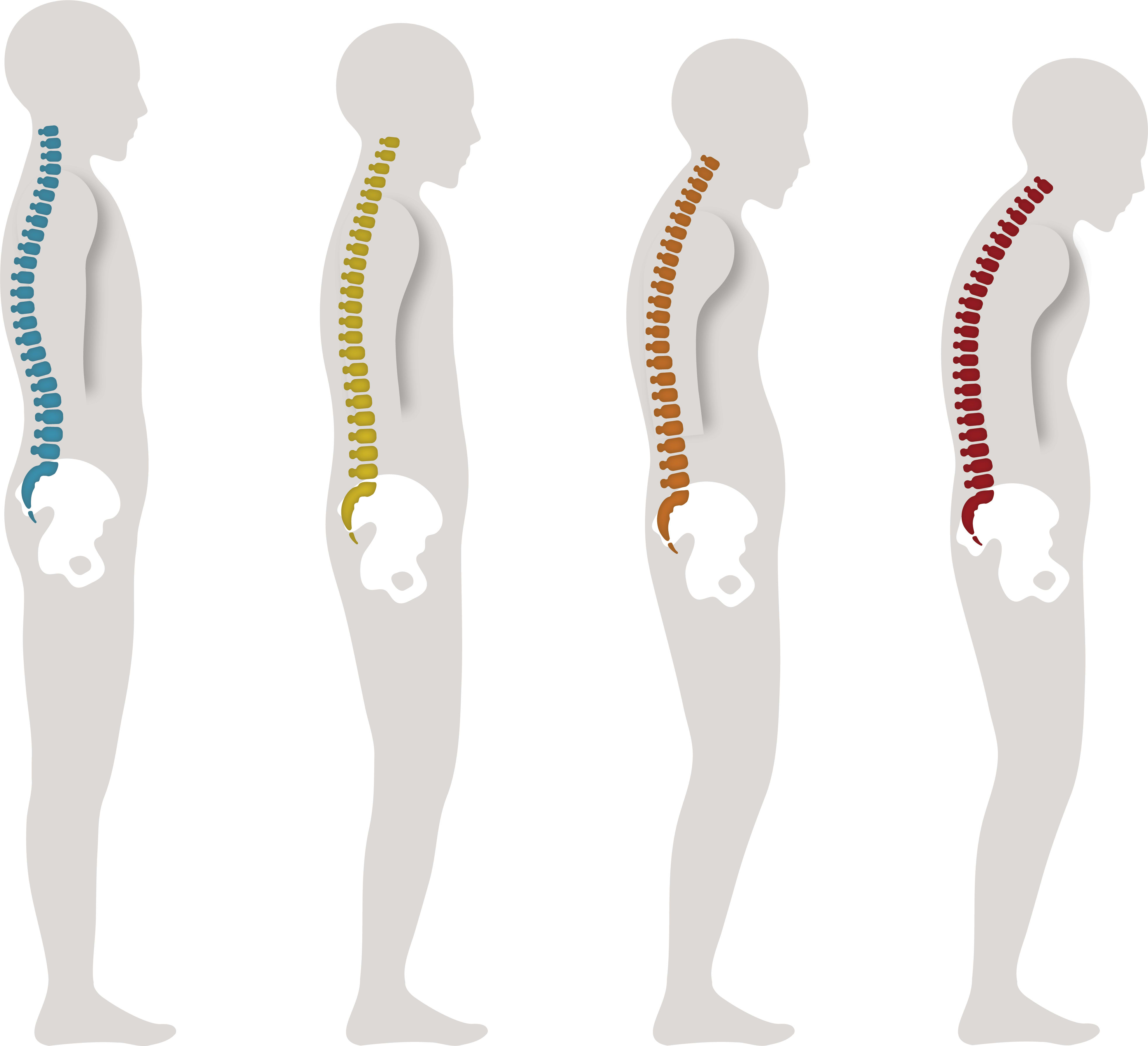 Preview image for Thoracic Decompression