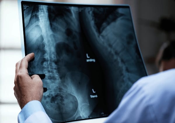 Pelvic-Floor-Dysfunction-ICD-10-thumb-1