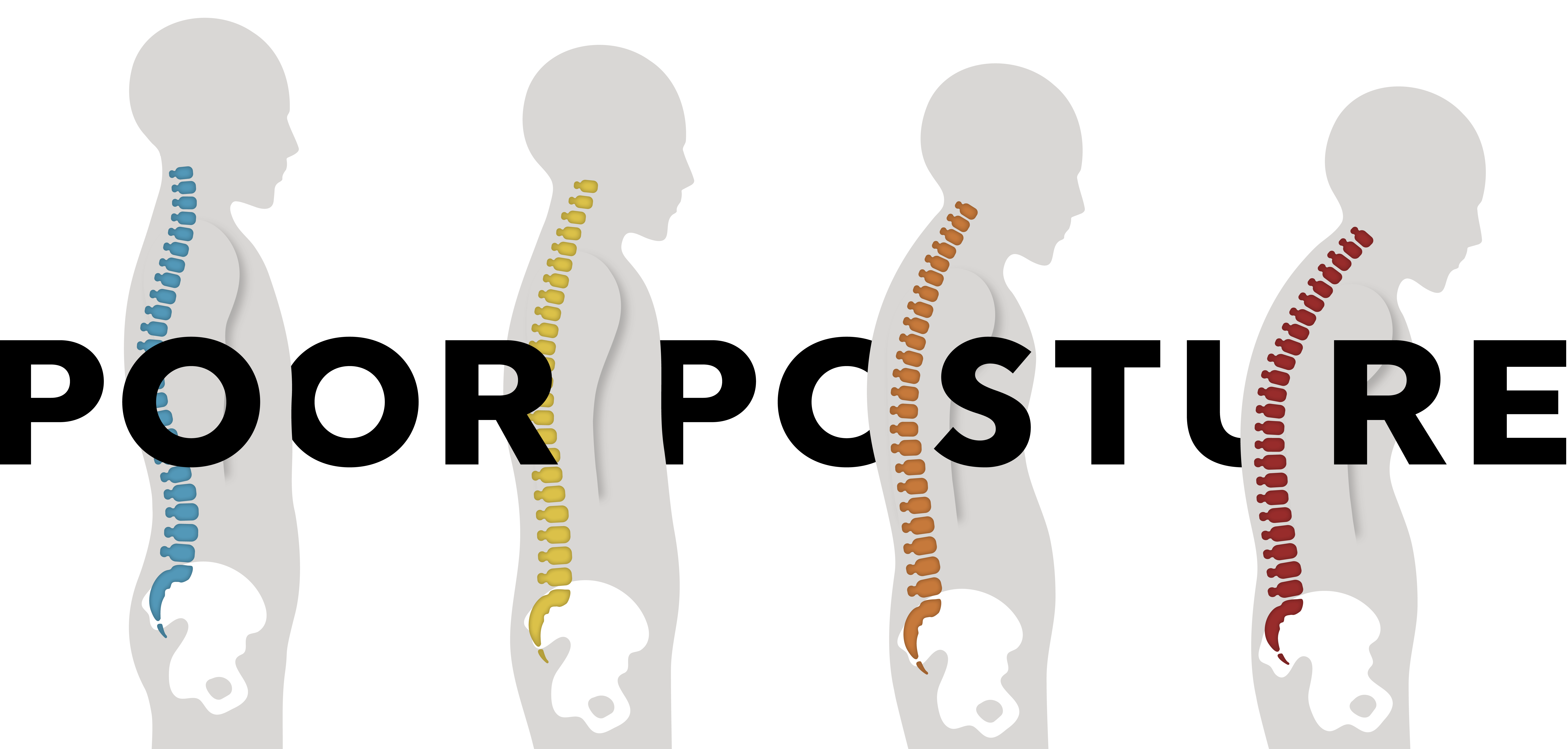 PoorPosture