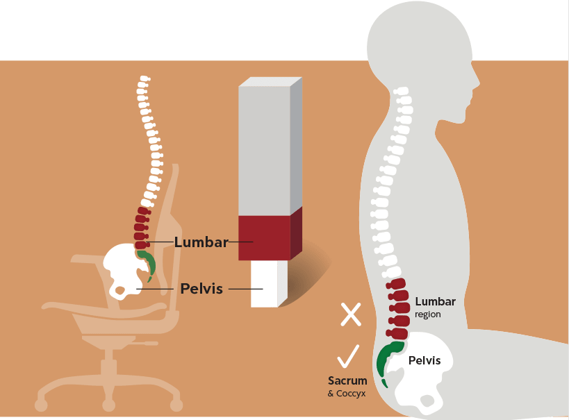 Preview image for Improve Your Posture: Support The Pelvis